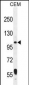 LARS2 Antibody (Center)